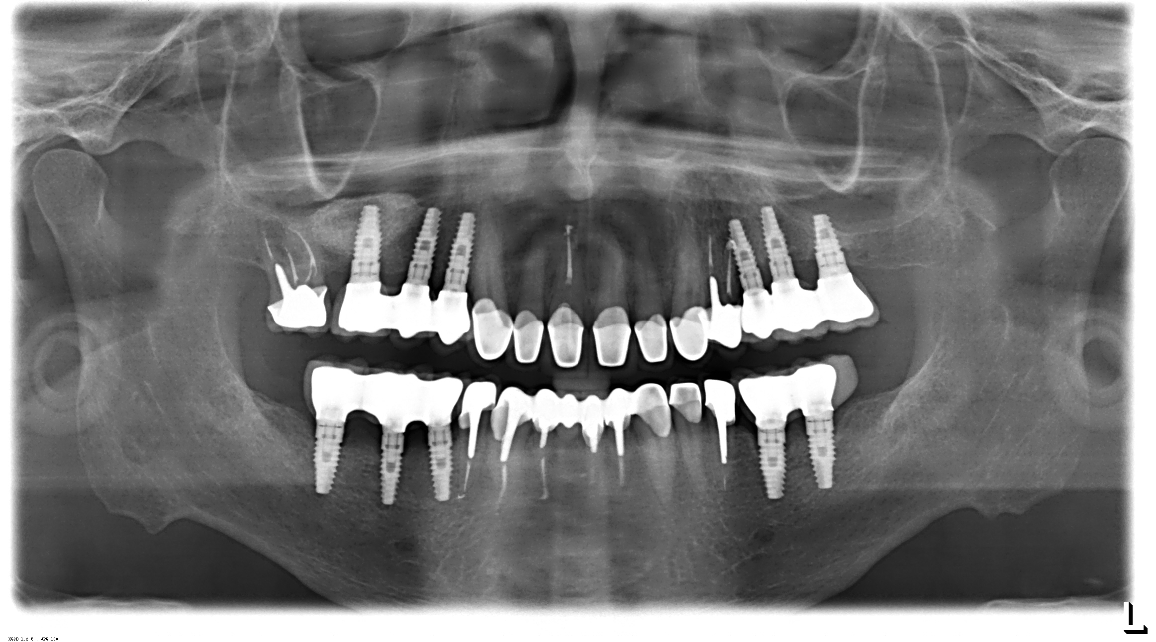 3D-снимок зубов: зачем нужно делать и что показывает